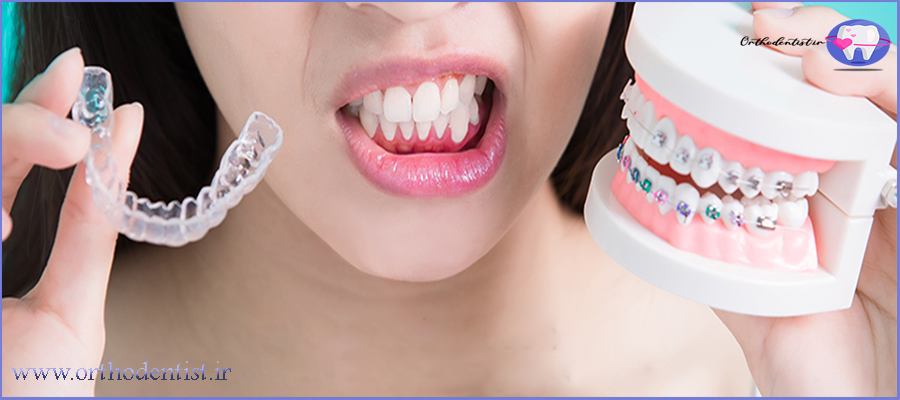 تفاوت ارتودنسی ثابت و متحرک