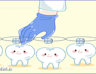 بریس ارتودنسی