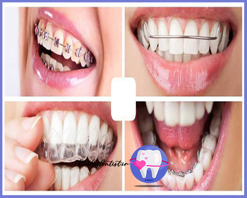 ارتودنسی فک بالا و پایین