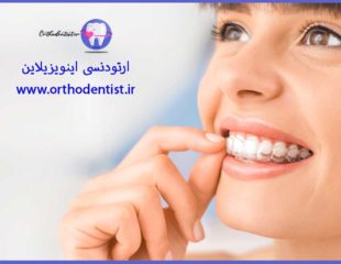 ارتودنسی اینویزیلاین