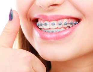 ضرر های ارتودنسی دندان-1