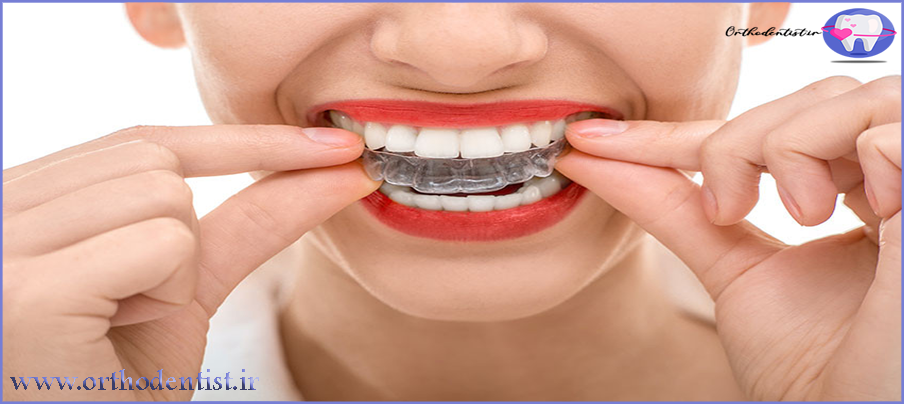 پیشرفته ترین ارتودنسی