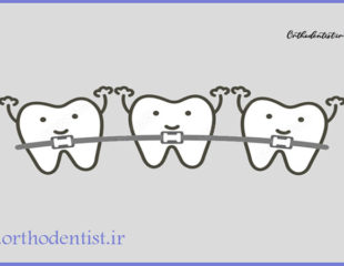 ارتودنسی یک دندان
