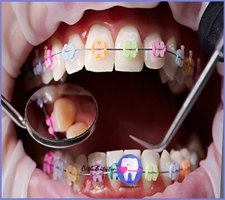 تفاوت بین دندان پزشک و متخصص ارتودنسی
