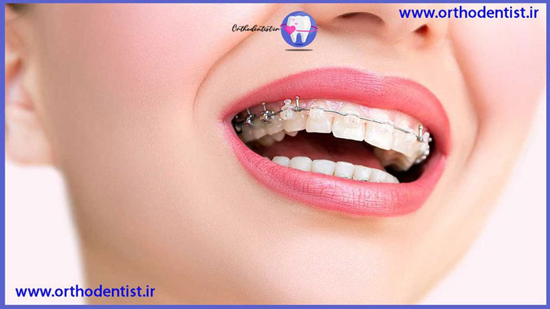 معاینات منظم دندانپزشکی