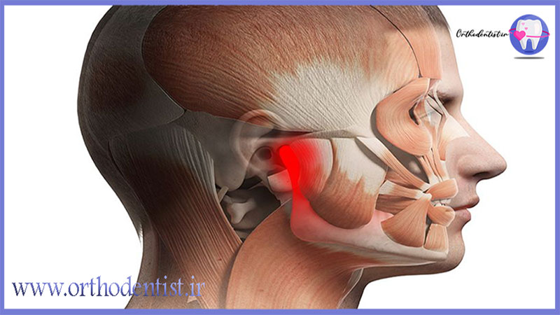 اختلالات TMJ