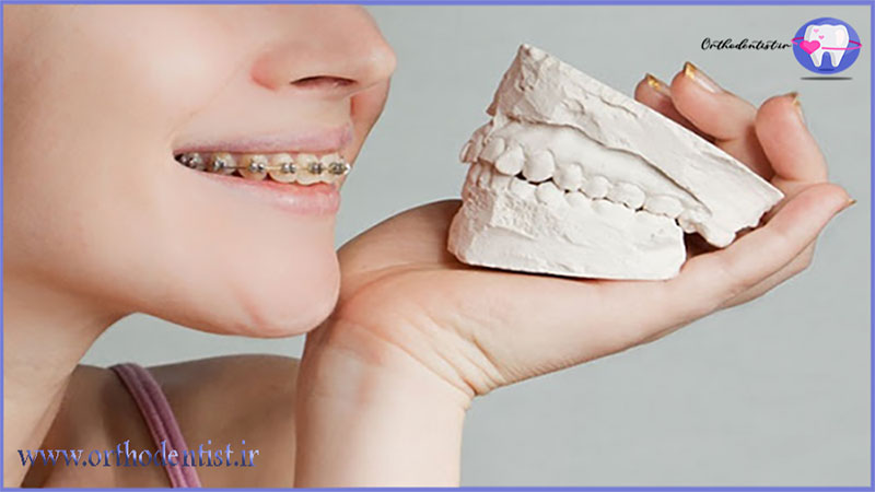 جلوگیری از لق شدن و از دست دادن دندان