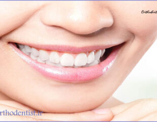 سفید کردن دندان ها بعد از ارتودنسی