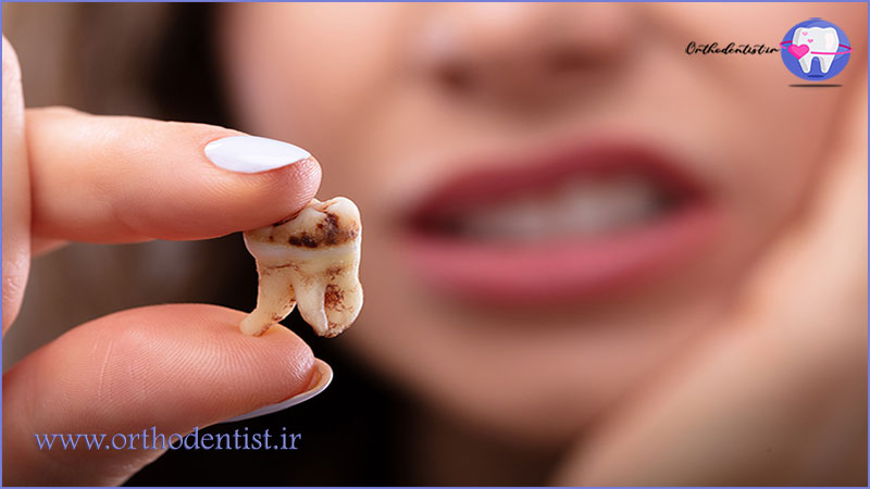 پیشگیری از مشکلات دندانی