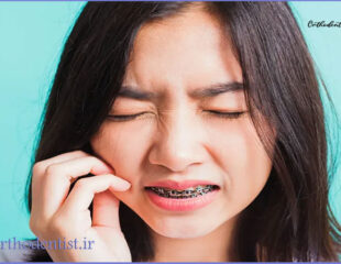 ارتودنسی دندان حساس
